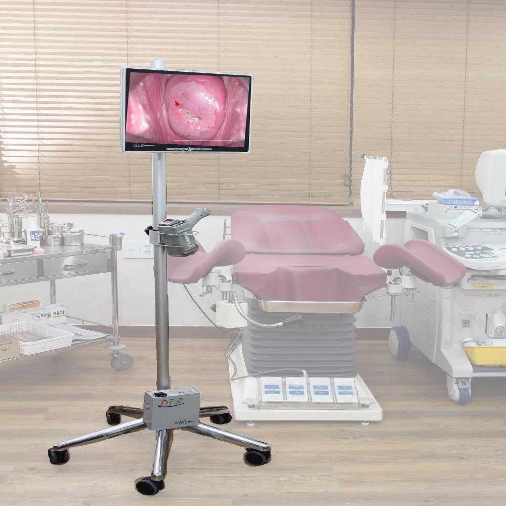 TeleCervico System