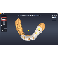 detail image3 [3D Industrial] DentiqGuide